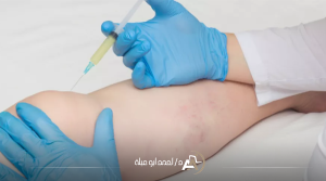 سعر حقن البلازما للركبة في مصر