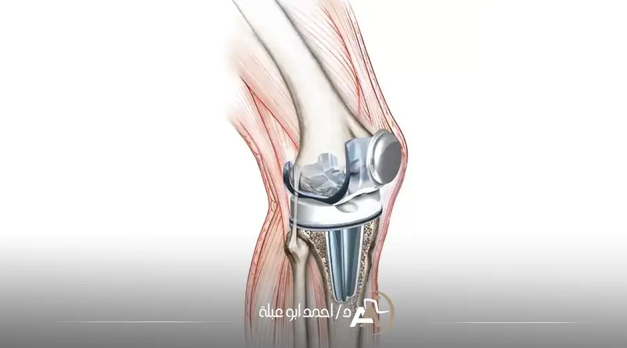 افضل دكتور عظام تخصص ركبة