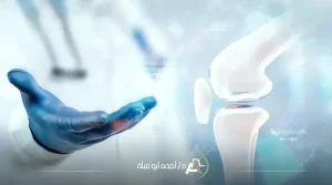 تكلفة عملية قطع غضروف الركبة​