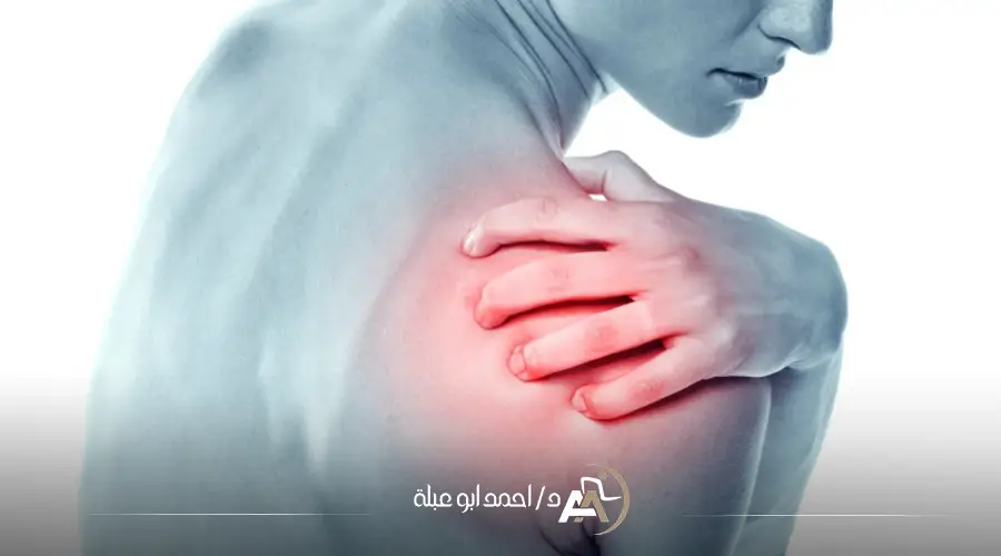 سعر عملية خلع الكتف