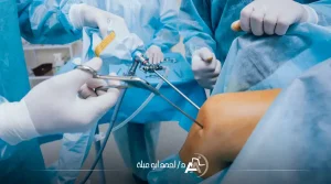 عملية قطع غضروف الركبة بالمنظار