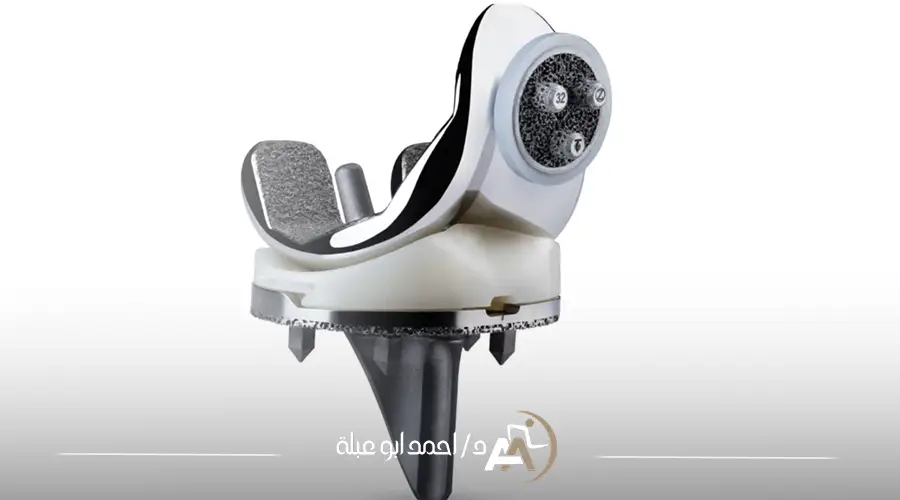 انواع مفاصل الركبة الصناعية