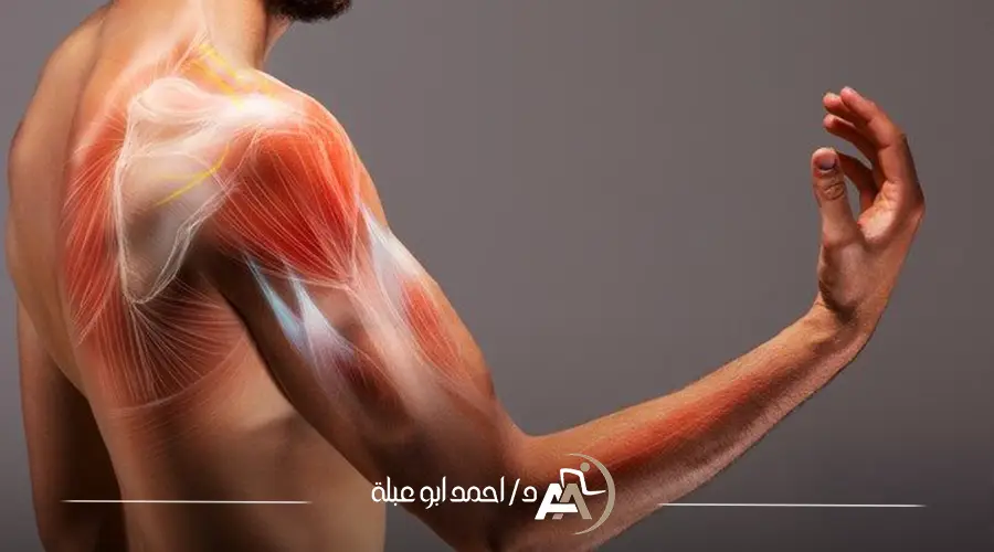 مده علاج خلع الكتف