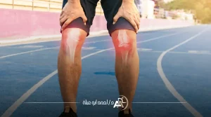 اعراض فشل عملية الرباط الصليبي